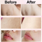 Dual Head Shaver - features