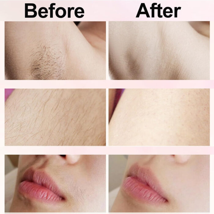 Dual Head Shaver - features